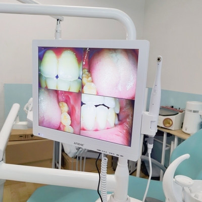 Wifi All In One Oral Camera With Loudspeaker LCD Screen Dental Oral Camera Scanner