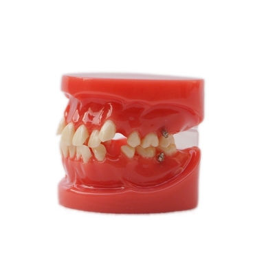 Training Use Dental Teeth Teaching Model Functional Dental Orthodontic Model Without Bracket