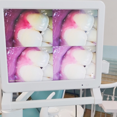 Dental Endoscope With 17 Inch Monitor Wifi Handheld Portable Dental Camera Intraoral Endoscope Intra Oral Camera
