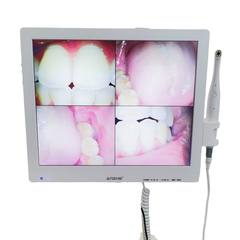 Wifi All In One Oral Camera With Loudspeaker LCD Screen Dental Oral Camera Scanner