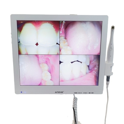 Wifi All In One Oral Camera With Loudspeaker LCD Screen Dental Oral Camera Scanner