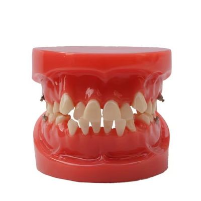 Training Use Dental Teeth Teaching Model Functional Dental Orthodontic Model Without Bracket
